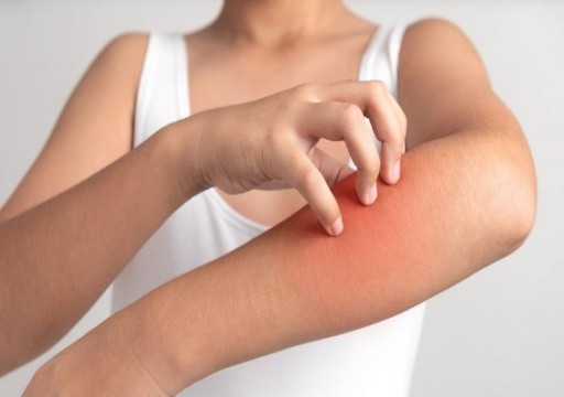 10 نصائح طبية للحفاظ على صحة الجلد في الصيف
