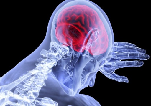 دراسة جديدة تحدد فئة الدم "الأكثر عرضة للإصابة بسكتة دماغية"