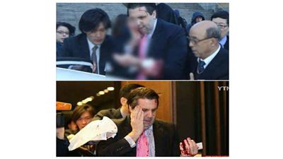 إصابة السفير الأمريكي في كوريا الجنوبية بهجوم مسلح
