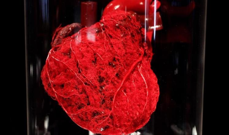 باحثون: ارتفاع الوزن قد يغير شكل القلب